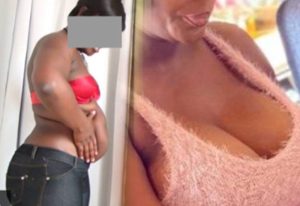 Read more about the article “Beauty or Burden”?: Ghanaian Ladies Share Harrowing Truths Behind Liposuction and Breast Augmentation