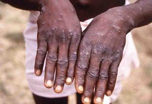 Read more about the article Consuming bush meat cannot spread monkeypox – Kumasi traders