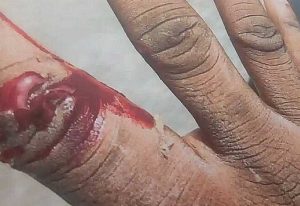 Read more about the article Driver jailed nine months for biting police officer’s fingers