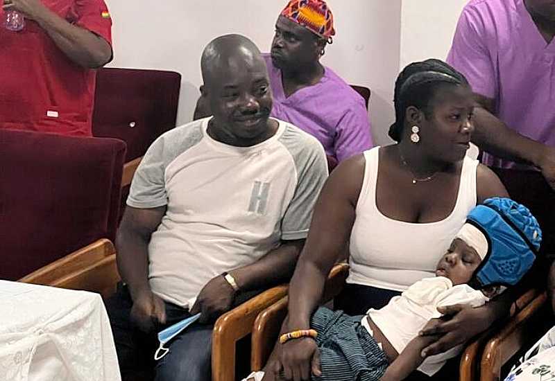 You are currently viewing Conjoined twins: Surviving twin stable; GHc24m spent so far – Medical Team